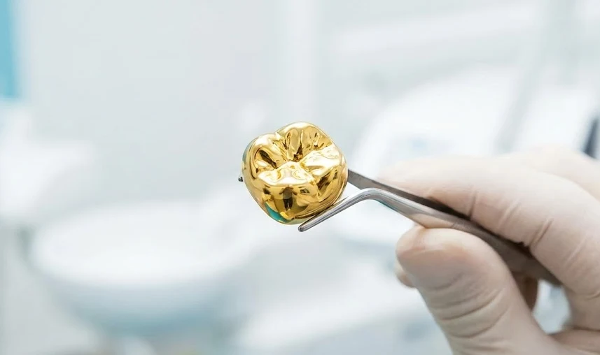 high noble gold crown lasting shine