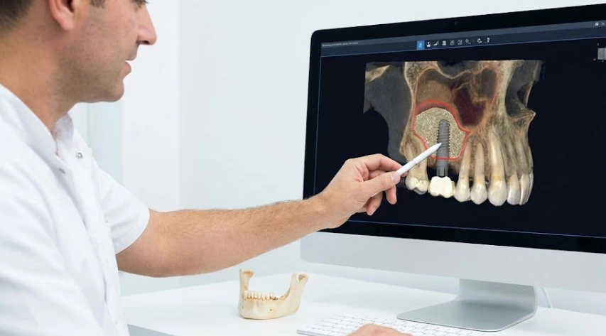 how-it-makes-impossible-dental-implants-possible