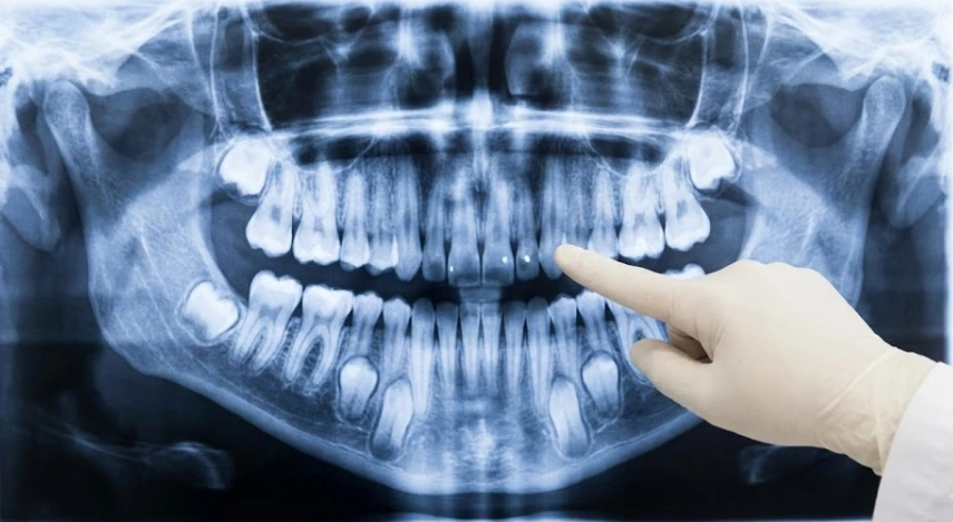 orthodontist-showing-dental-model