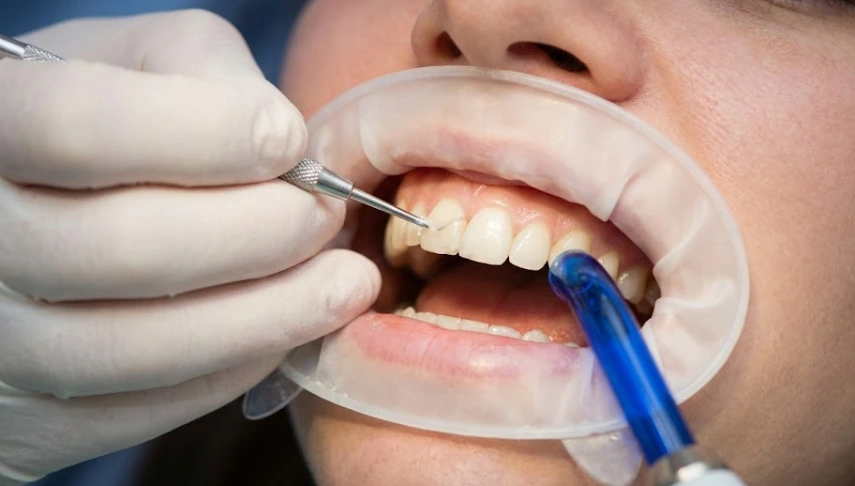 precise-aesthetic-dental-restoration