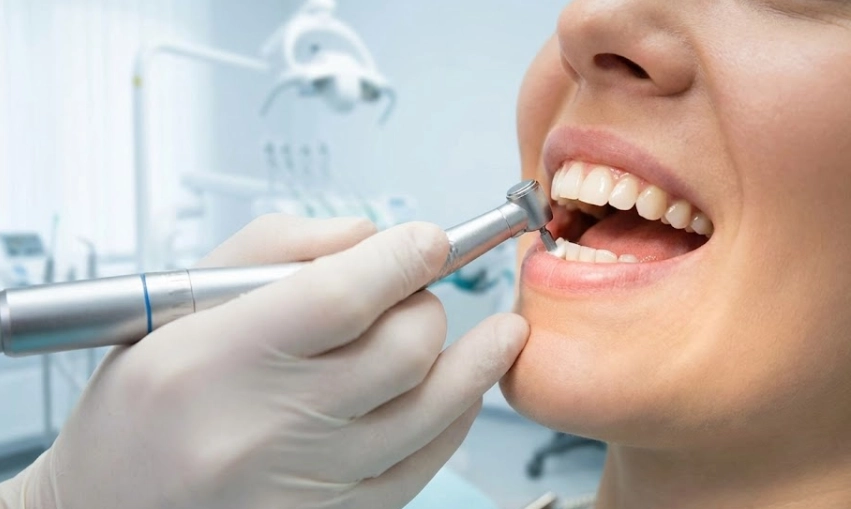 professional dental cleaning session