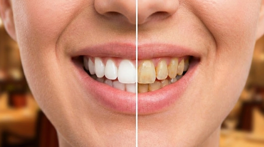 red-wine-stains-before-and-after