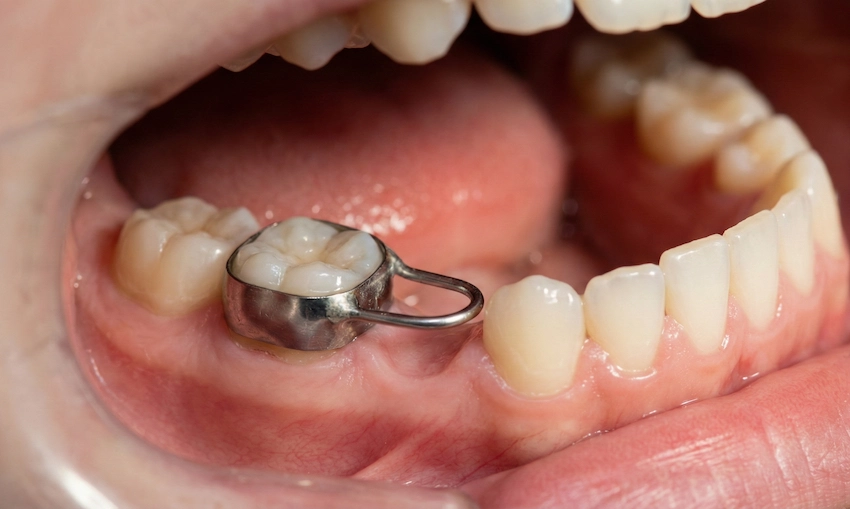 plassholder for barn