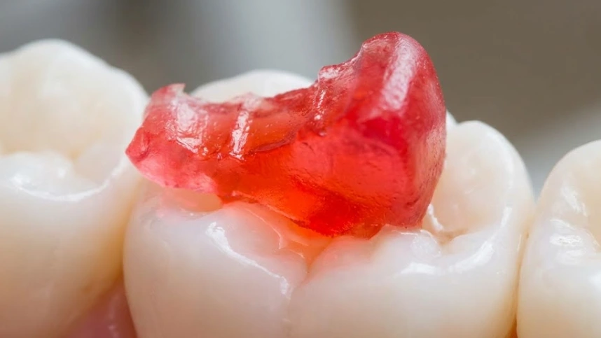 sticky-candy-on-molar-tooth