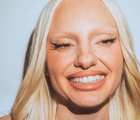 alexandra stan hollywood smile