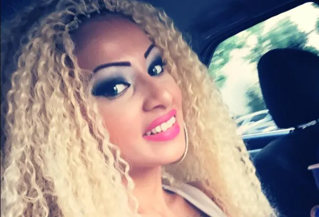 dientes de Cristina Pucean en 2015