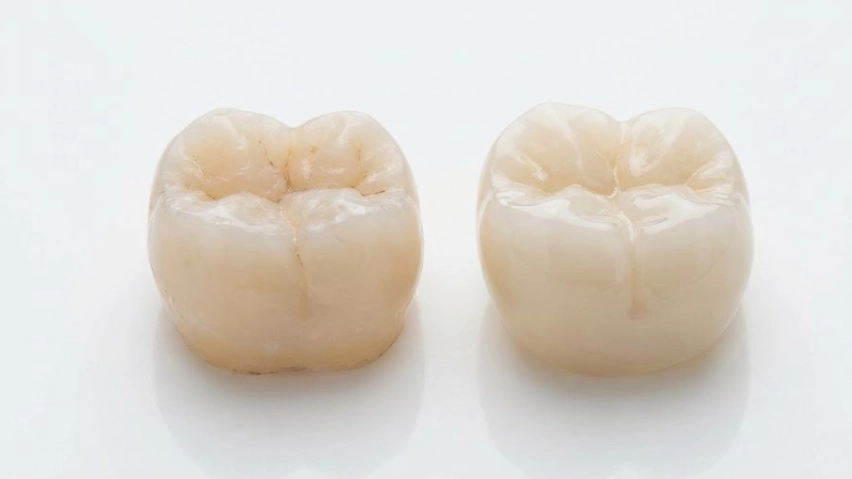 confronto tra denti naturali e zirconia
