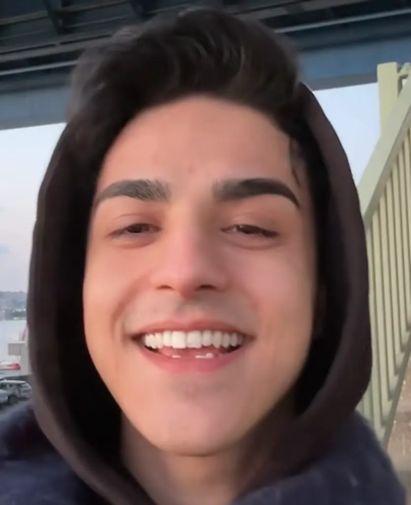 ozgur deniz cellat teeth 2024