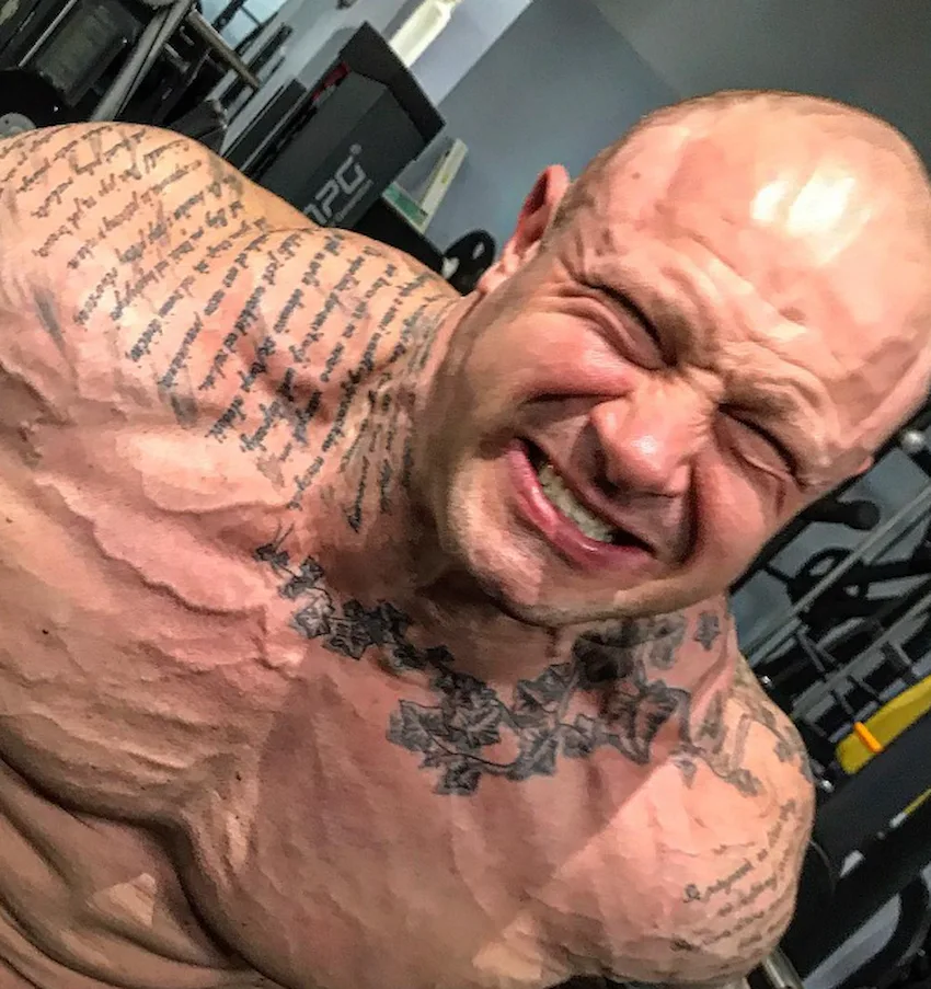 piotr piechowiak teeth 2022