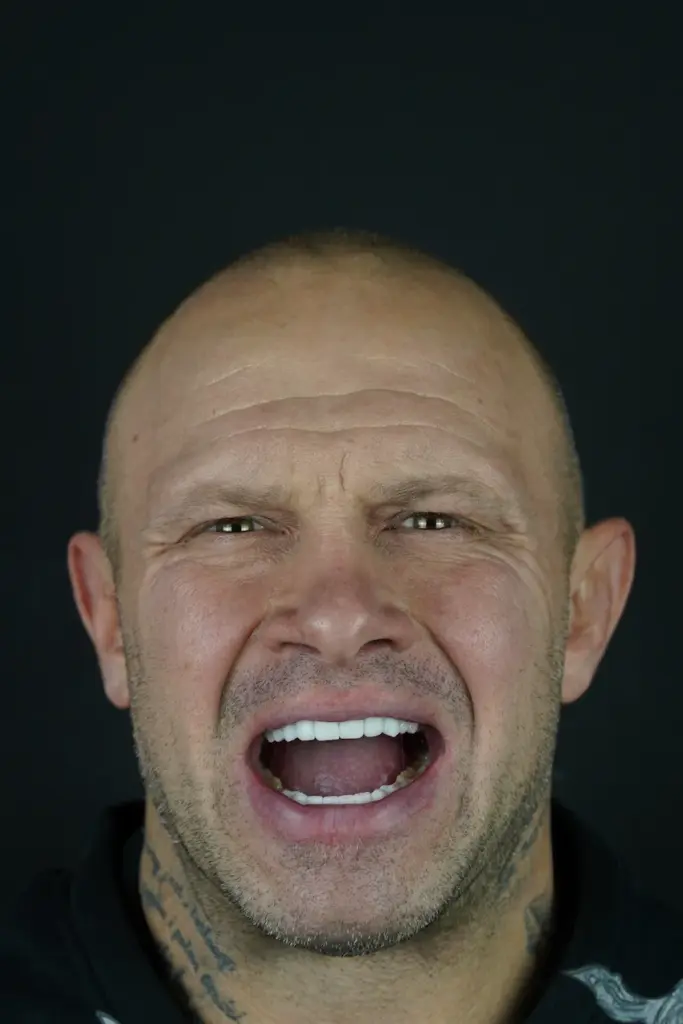 piotr piechowiak teeth 2026
