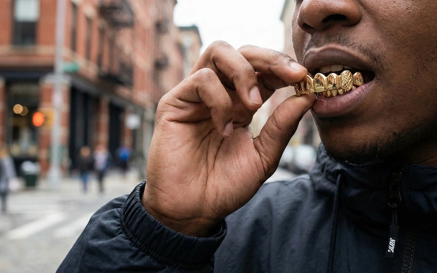 joyería dental de estilo con grillz removibles