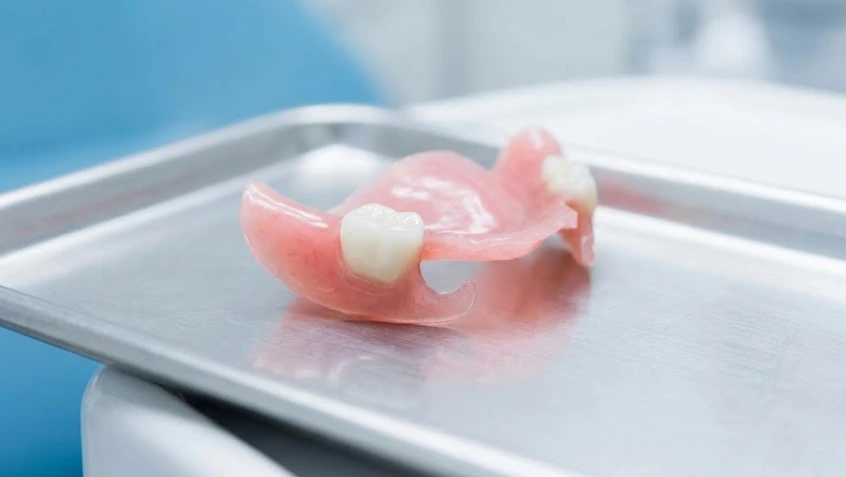 Tek Diş İçin Çıkarılabilir Protez Aygıtı