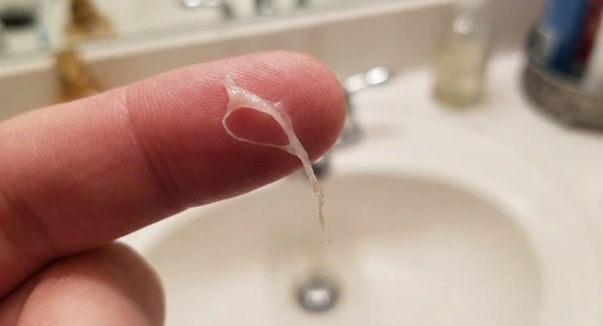 stringy white oral tissue on finger