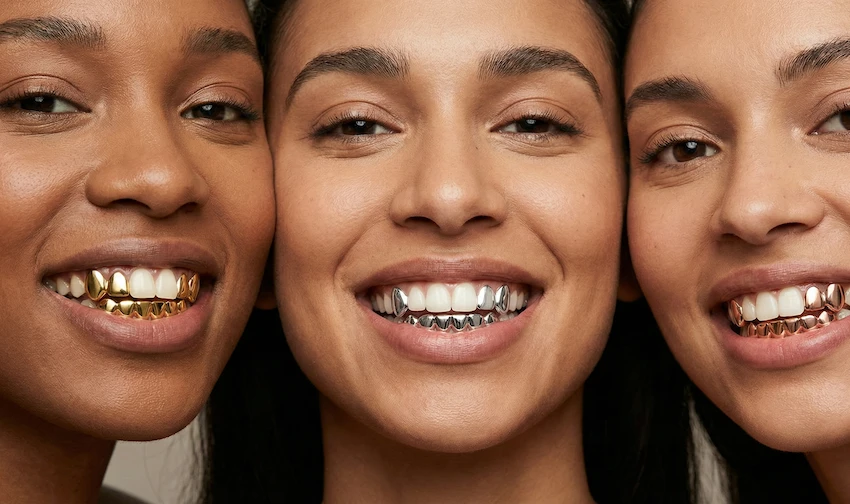 yellow white rose gold grillz smile comparison