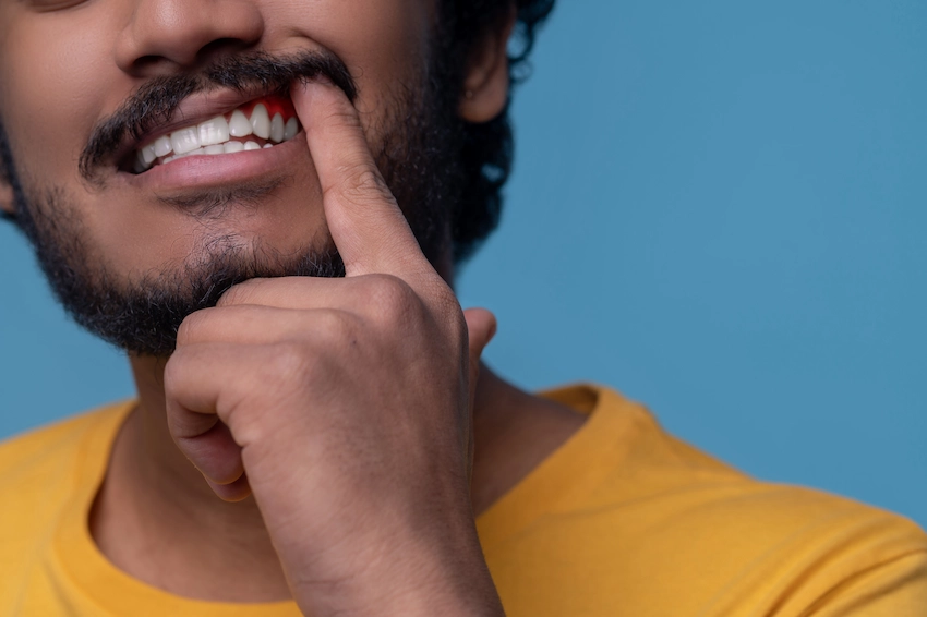 patient showing gum disease gingivitis symptoms