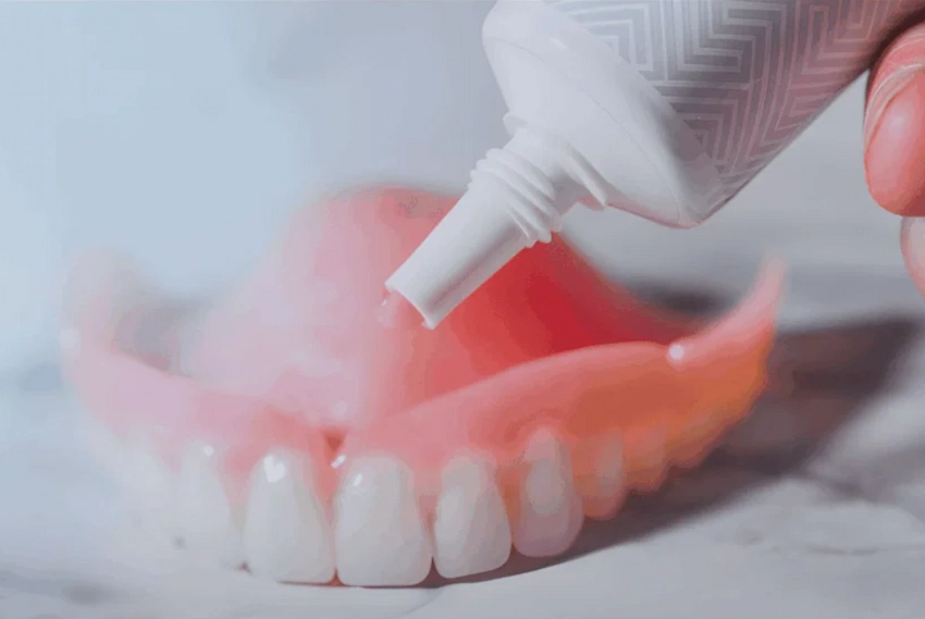 applying adhesive paste to traditional denture