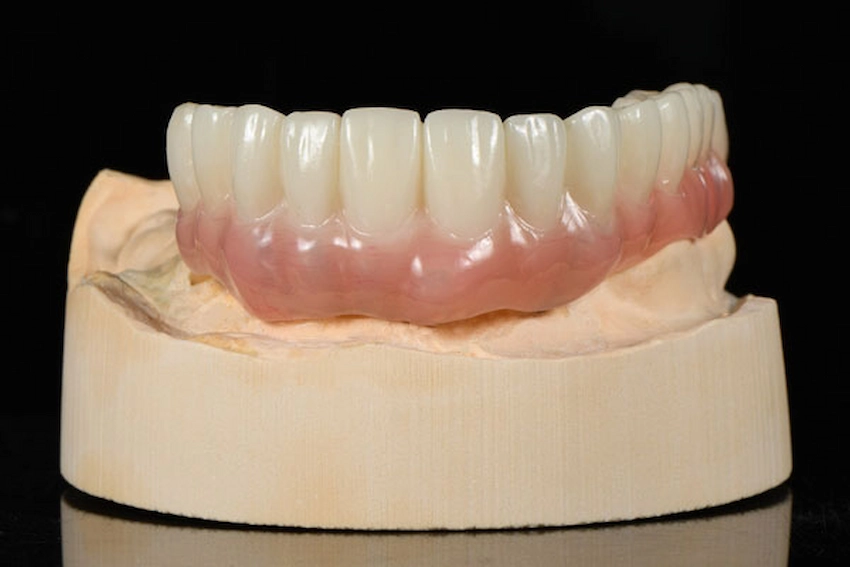 can i use denture adhesive for a temporary crown can i use denture adhesive for a temporary crown