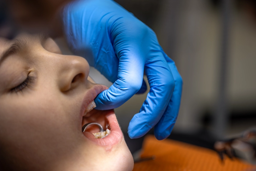 dentist checking young patients teeth