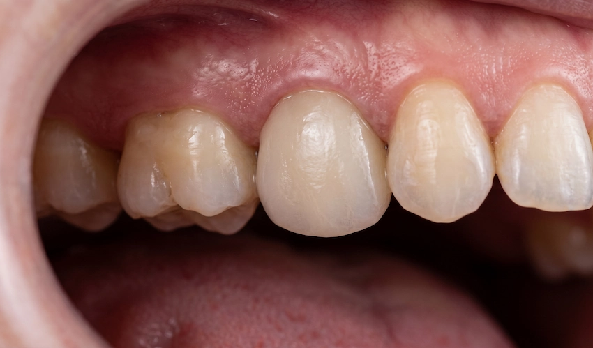 healthy gums healthy teeth macro photography
