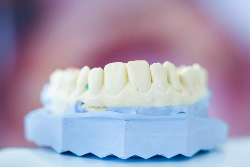 how long after extractions can you use denture adhesive how long after extractions can you use denture adhesive