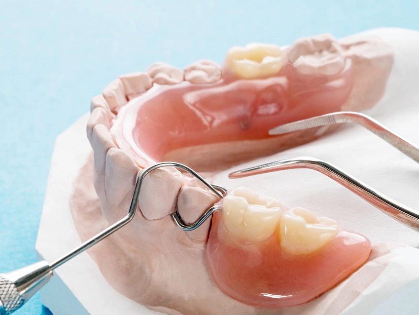how to apply adhesive to partial dentures how to apply adhesive to partial dentures