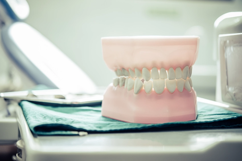 implant supported overdenture model lema dental clinic istanbul