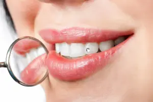 single diamond tooth gem professional removal
