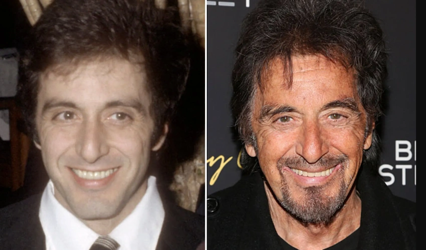 al pacino teeth before after