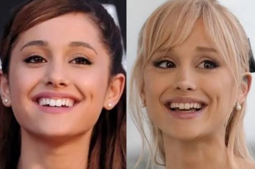 ariana grande teeth before after