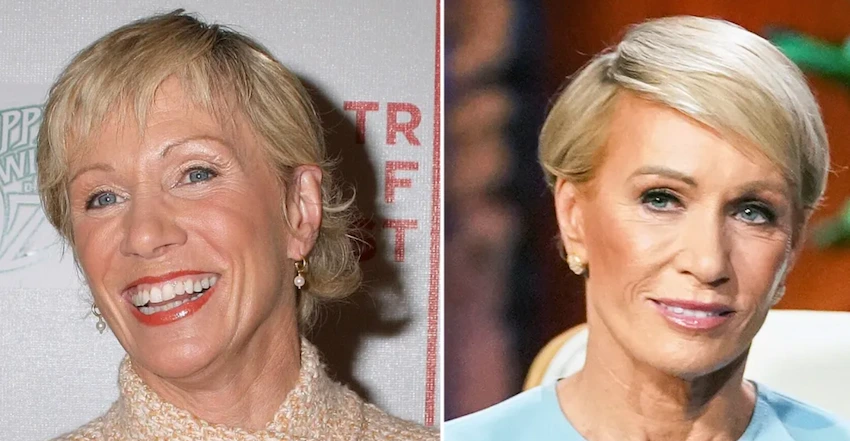 barbara corcoran teeth before after