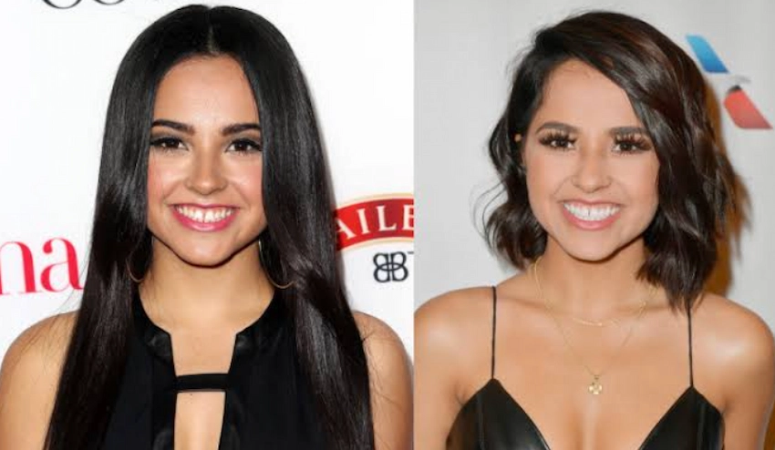 becky g teeth before after