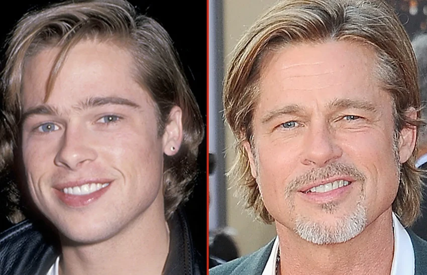 brad pitt teeth before after