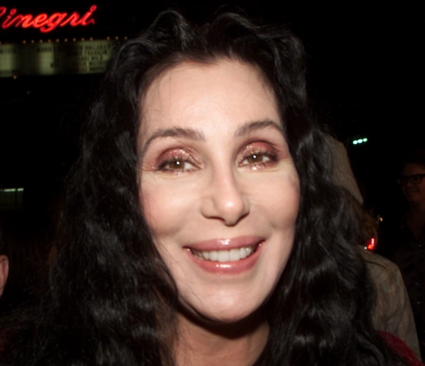 cher teeth 2001