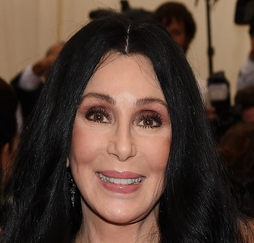 cher teeth 2015