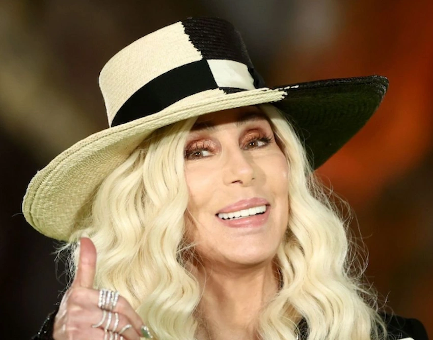 cher teeth 2020