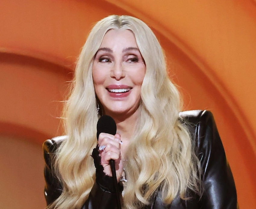 cher teeth 2026
