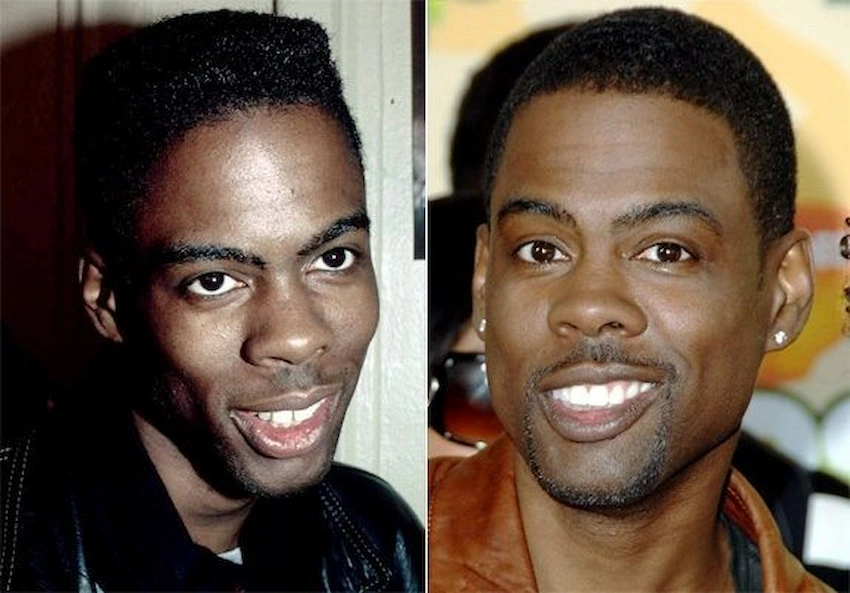 chris rock teeth before after smile
