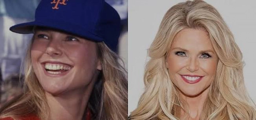 christie brinkley teeth before after