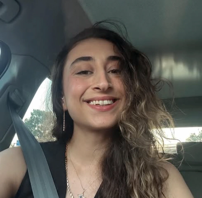 elif sahin teeth 2024 elif sahin teeth 2024