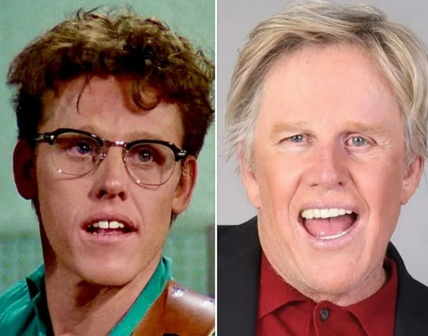 gary busey teeth before after gary busey teeth before after