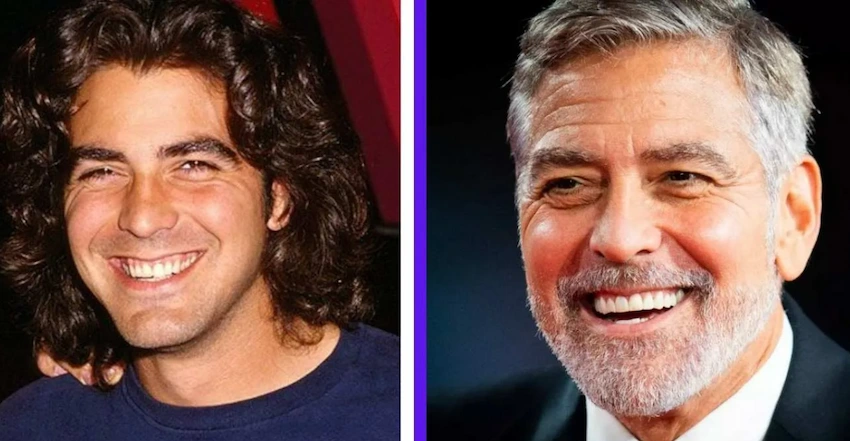 george clooney teeth before after