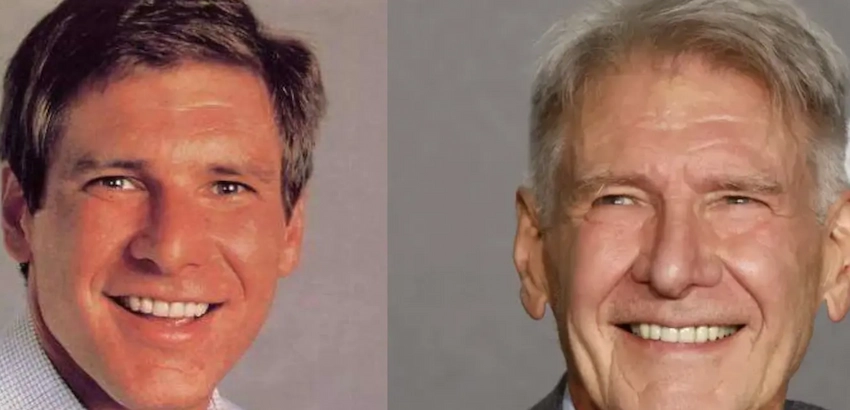 harrison ford teeth before after