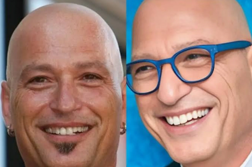 howie mandel teeth before after