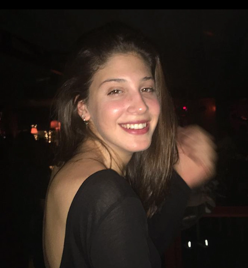 ilkin aydin teeth 2018 ilkin aydin teeth 2018