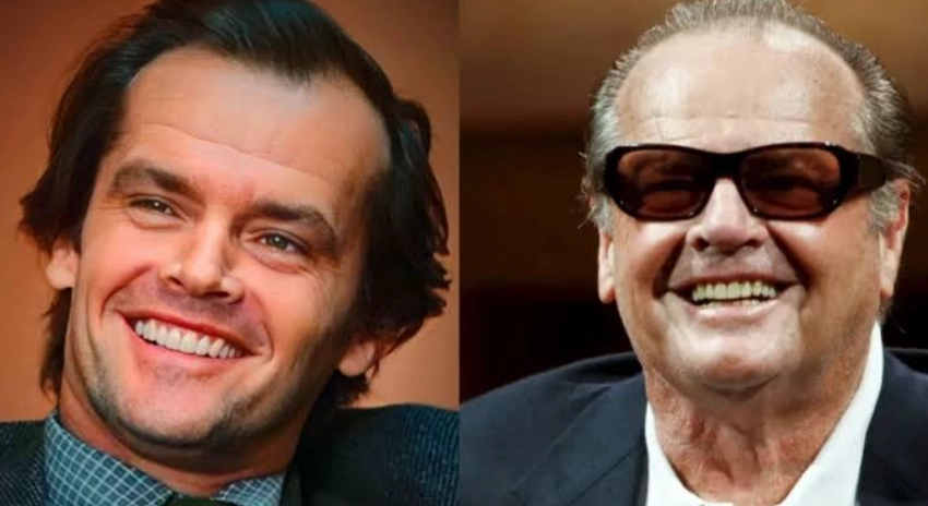jack nicholson teeth before after