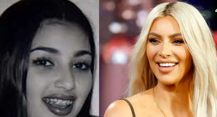 kim kardashian teeth before after kim kardashian teeth before after