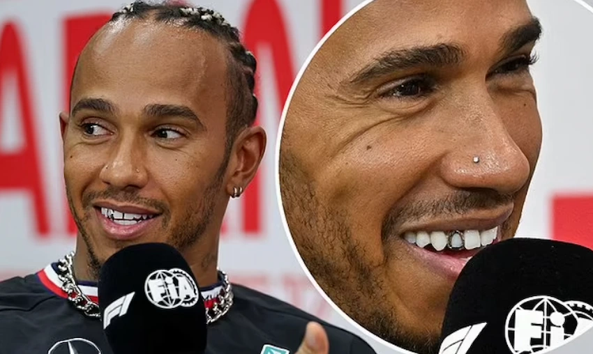 lewis hamilton teeth before after