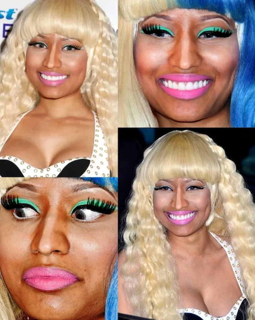 nicki minaj teeth before after