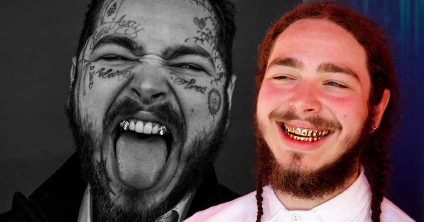 post malone teeth before after post malone teeth before after