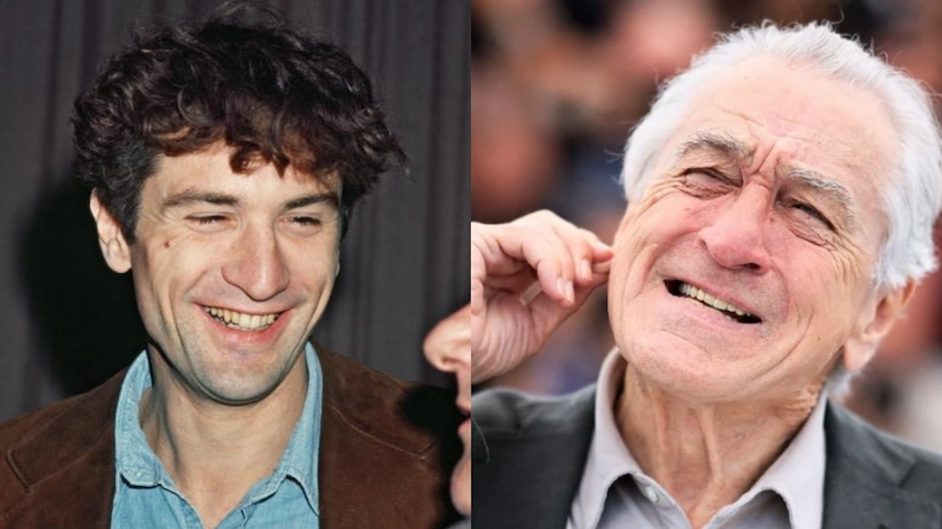 robert de niro teeth before after